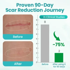 Timilk® EliteAloe ScarSolve Spray