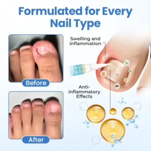Timilk® MycoErase Nail Revive Pen
