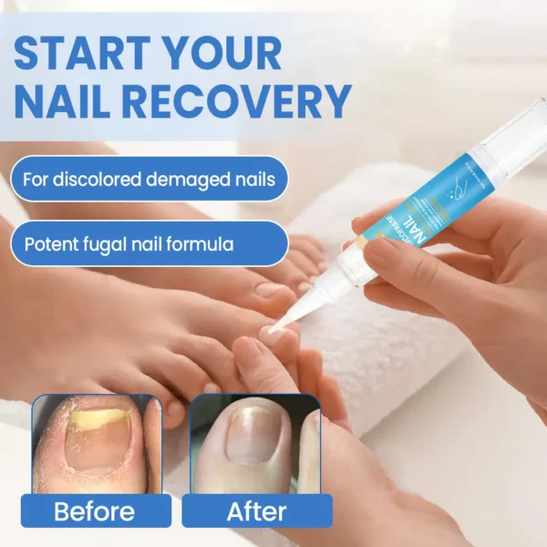 Timilk® MycoErase Nail Revive Pen