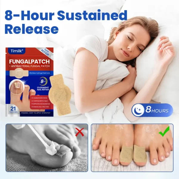 Timilk® FungalPatch - Antibacterial Fungal Patch⭐