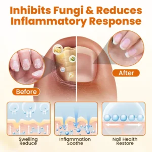 Timilk® FungiBee Advanced Nail Repair Spray⭐