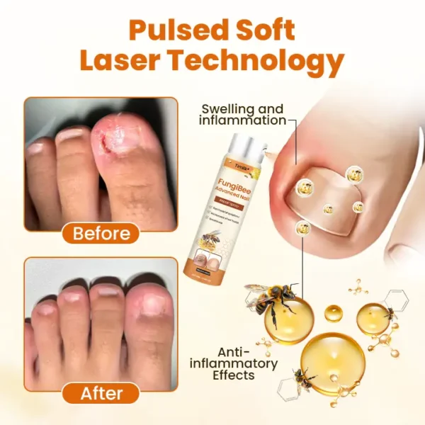 Timilk® FungiBee Advanced Nail Repair Spray⭐