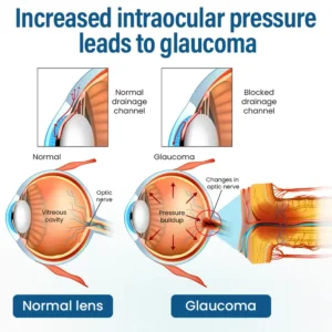 Timilk® VisionReborn Nano Eye Drops