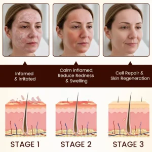 Timilk® Bee Venom Multi-Repair Cream (A)