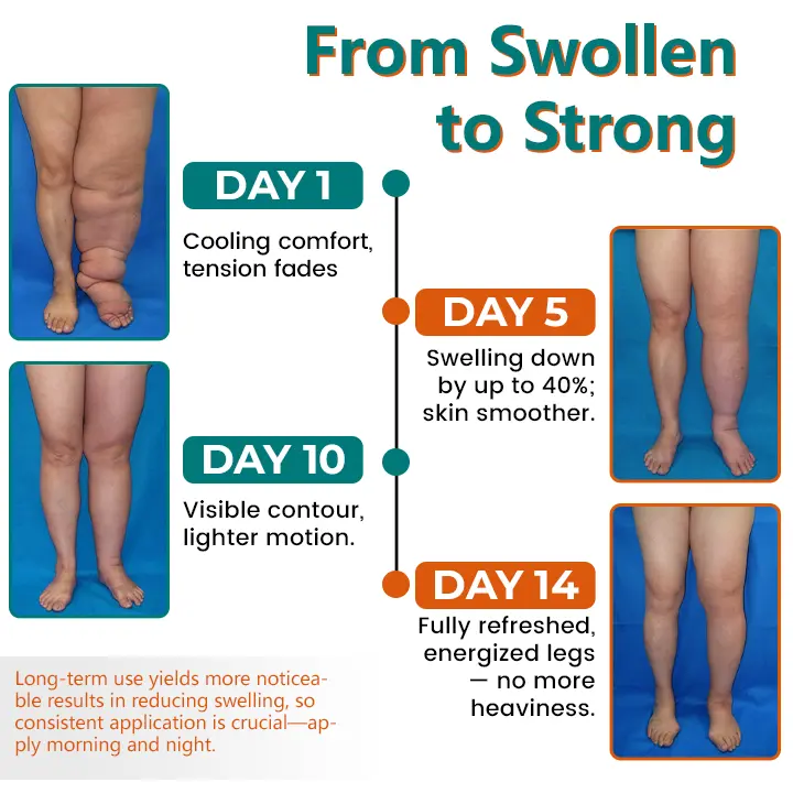 Timilk® LymphoEase Magnesium Roll-On Relief Cream