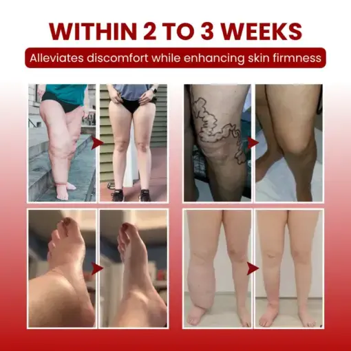 Timilk® SwellCare Professional Lymphatic Drainage Massage Cream