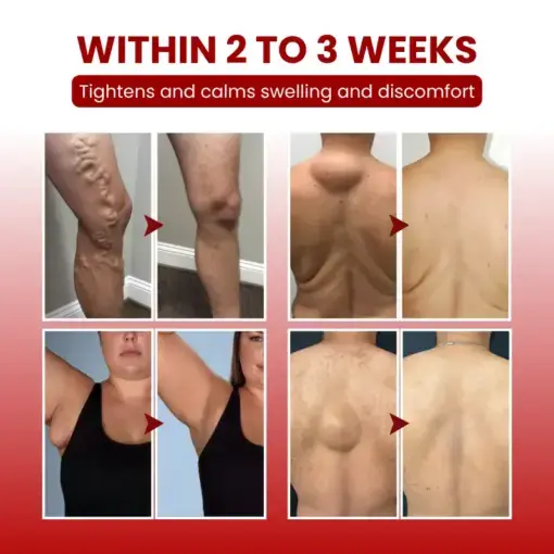 Timilk® SwellCare Professional Lymphatic Drainage Massage Cream