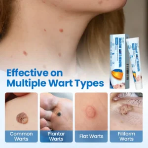Timilk® TagGone Wart Removal Cream
