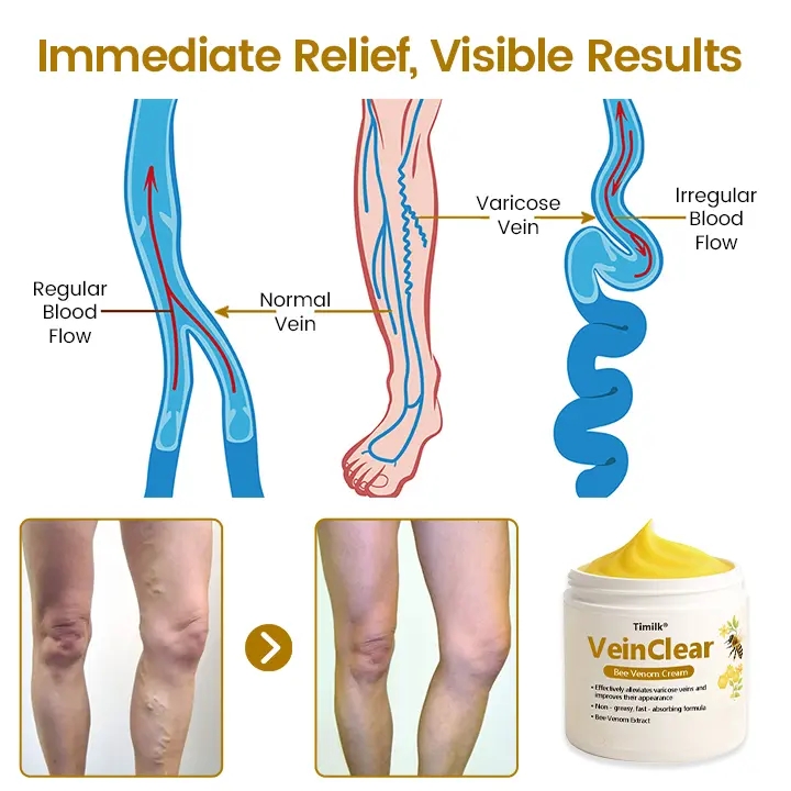 Timilk® VeinClear Bee Venom Cream |✨ Visible Relief in Just 7 Days! 🦵🌿
