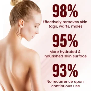 Timilk® Vionara Nano WartErase Patch🔥