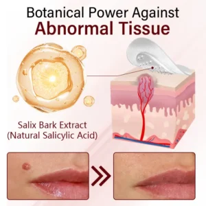 Timilk® Vionara Nano WartErase Patch（A)