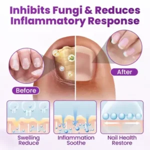 Timilk® AeroFilm Foot Defense Mist